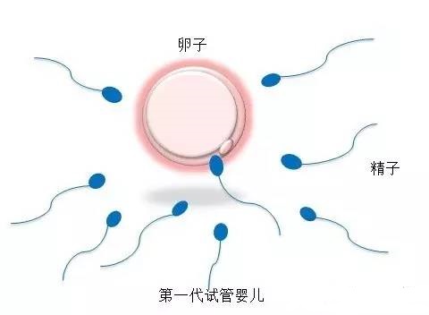 高齢初産